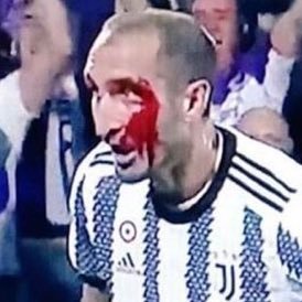 #FORZAJUVE 🇮🇹🇻🇪