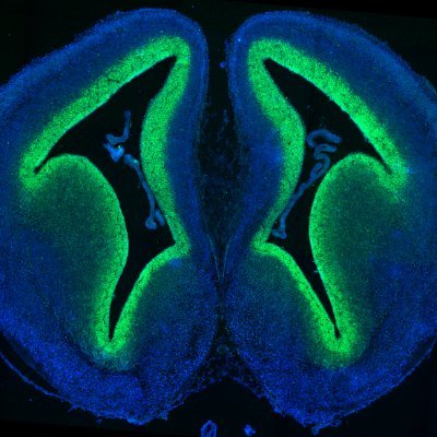 NIH-funded research at Harvard/ MGH on human genetics and molecular mechanisms of neurodevelopmental anomalies. Visit our website to get involved in a study!