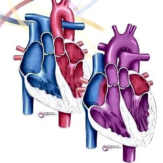 Ped cardiac surgeon @USA 小児心臓外科医