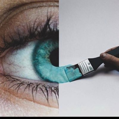 KAU-med14 👁 Ophthalmology || طب و جراحة عيون || 🐱 ||🎶 || 🖋