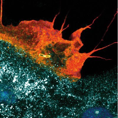 We study infection and inflammation in the gut with focus on the endogenous danger signal extracellular ATP.