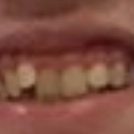 Hello I am drazah’s teeth