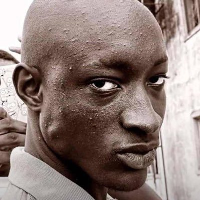 Kenny_Makoko's profile picture. 🦀 Very Territorial Proudly 6'3' IC3 Gamer 🎮 Basketball 🏀 and Sleeping 😴 Always behind a mask😎 Location: Mars 🚀