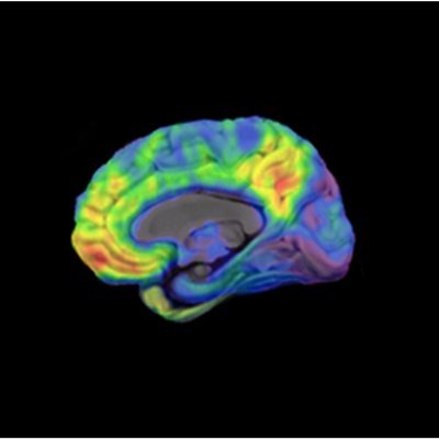 Molecular imaging lab investigating biomarkers (PET & blood) for neurodegenerative diseases, focusing on early detection & therapeutic intervention in AD.