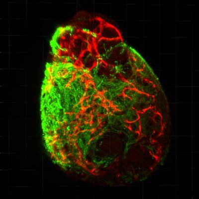 Cardiovascular development & disease | Stem Cell Biology | Cardiac Organoids | Organ-on-Chip | @GlobalLUMC| @RENEW_Global.  Tweets by group members.