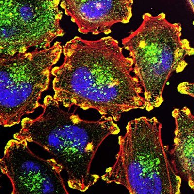 Physician-scientist, Neal Rosen’s lab at MSKCC focuses on understanding biochemical mechanisms in tumors and developing new therapeutic strategies.