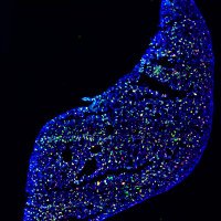 NijagalLab (@nijagallab) 's Twitter Profile Photo NijagalLab (@nijagallab) 's Twitter Profile Photo