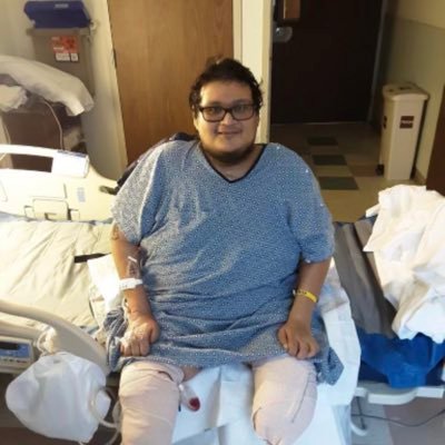 I am a quadriplegic and amputee follow me instagram: nadoe90, snapchat nadoe90