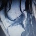 前十字靭帯自然治癒しました!ACL healed spontaneously (@92014168mm) Twitter profile photo 前十字靭帯自然治癒しました!ACL healed spontaneously (@92014168mm) Twitter profile photo