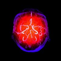 Circle of Willis (@circle_ofwillis) 's Twitter Profile Photo Circle of Willis (@circle_ofwillis) 's Twitter Profile Photo