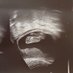 mamaaaaaa🤰👩⚕️ (@mamafarma8) Twitter profile photo mamaaaaaa🤰👩⚕️ (@mamafarma8) Twitter profile photo