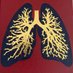 Bronchiectasis papers (@bronchiectasisx) Twitter profile photo Bronchiectasis papers (@bronchiectasisx) Twitter profile photo