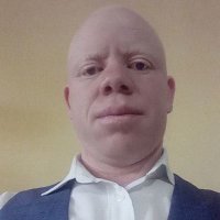 Albinism Network Zimbabwe (@albinismconnect) 's Twitter Profile