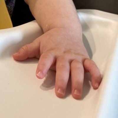 2022.3生まれの女の子の発達不安アカ。新生児の頃から違和感あり。父親が多分アスペ。父親の家系に自閉症あり。海外住み。