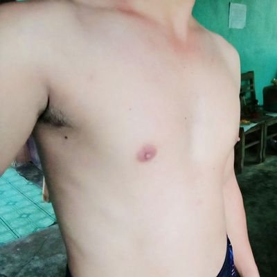 Simple