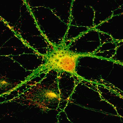 The McAllister Lab studies how immune molecules regulate brain development and how immune dysregulation contributes to brain disease.