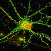 McAllister Lab (@mcallisterlab) 's Twitter Profile