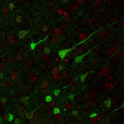 MasterNeuroBA's profile picture. Máster en #Neurociencias Básicas y Aplicadas @UV_EG. @BiologiquesUV, @psicologia_UV, @Medicina_UV. Gestionado por @unitatweb y @CarmenAgustin