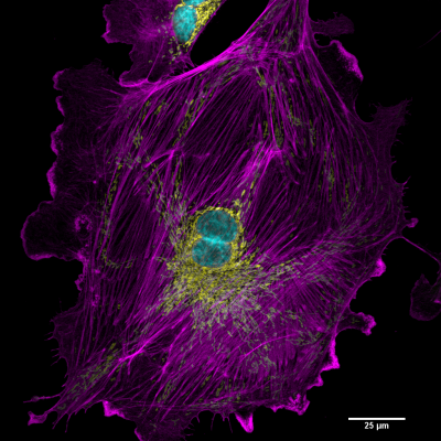 The ALMF is a part of the Center for Open Research Resources and Equipment at UConn. We provide microscopy expertise and access to cutting edge instruments.