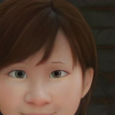 小鼻縮小⏩️鼻孔縁挙上
ダウンタイムを共有します。
小鼻縮小で、小鼻は小さくなったけど不自然な形に地獄をみました。
術後３ヶ月目で起死回生、鼻孔縁挙上をしてきました。経過をシェアします😅
同じ地獄を味わってる人のため症例写真を時々公開しますが、RT、転載、保存は辞めてくださいね🈲
皆さんマナー守ってくれて感謝です！