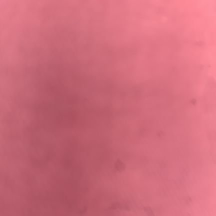PLHIv poz ( 12/9/21 nagsimula ang lahat cd4 - 76 )