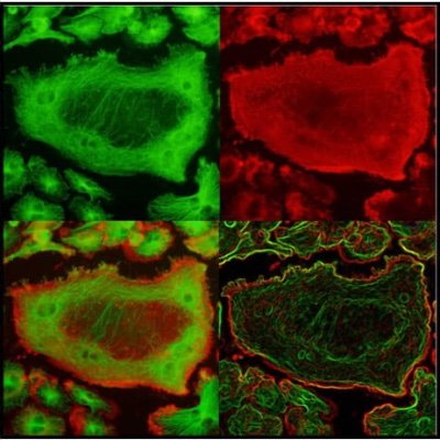 Official Twitter Account of Roberta Faccio's Orthopaedic research lab studying regulatory mechanisms in Inflammatory Arthritis and Bone Metastases