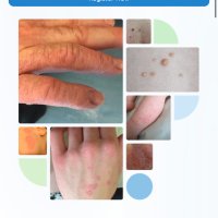 PCDSI- Primary Care Dermatological Society Ireland (@pcdsireland) 's Twitter Profile Photo PCDSI- Primary Care Dermatological Society Ireland (@pcdsireland) 's Twitter Profile Photo