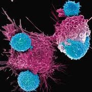 Chimeric Antigen Receptor T-Cell (CAR-T) & Gene Rx(@CARTTherapy) 's Twitter Profile Photo