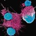 Chimeric Antigen Receptor T-Cell (CAR-T) & Gene Rx (@carttherapy) Twitter profile photo Chimeric Antigen Receptor T-Cell (CAR-T) & Gene Rx (@carttherapy) Twitter profile photo