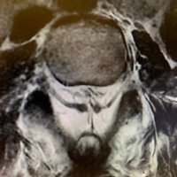 Jonathan Martin, MD (@jemartinmd) 's Twitter Profile Photo Jonathan Martin, MD (@jemartinmd) 's Twitter Profile Photo