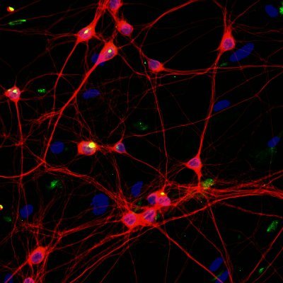 Integrating multidisciplinary concepts & methods to decode neural network behaviour in health and disease
@ntnu.edu/web/inb/sandvig#/ #neuroscience #computation