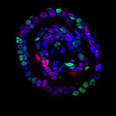 Welcome to the Ganesh Lab twitter account, where we'll post lab updates and everything related to #CRC #organoids #metastasis @mskcc