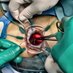 ColorectalResearch_ICH (@cresearchich) Twitter profile photo ColorectalResearch_ICH (@cresearchich) Twitter profile photo