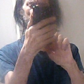 was abused after I was in bicycle crash when I was 12 by dr . He knew he was giving the wrong prescription drug zarotin .doctors are assholes & bitches .