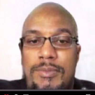 alvarezzjackson's profile picture. estetik surgery yaptım abi