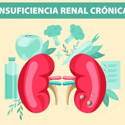 Conocer e informar sobre conocimientos de la enfermedad Insuficiencia Renal Crónica también conocida como IRC. 
¿Qué es?
¿Síntomas?
¿Como se manifiesta?