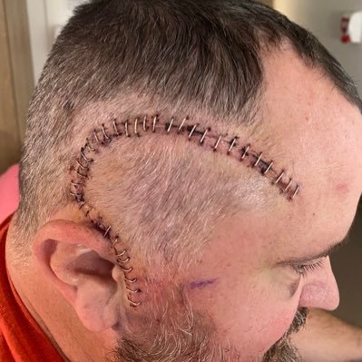 bjdfnc's profile picture. Fox News Foreign Affairs Producer - glioblastoma iv survivor: 1 year so far. Please reach out if you are the same and want to chat…positivity is infectious!