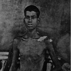 Killed, raped by Ali brothers,moplah Muslims and muslim congress leaders, abandoned by Gandhi, forgotten by my people. 