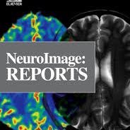 NeuroImage:Reports is an open-access and peer reviewed online-only companion journal to NeuroImage.
