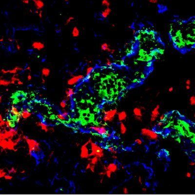 We bridge immunology and cardiorespiratory disease!
