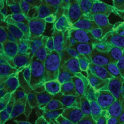 Cell, molecular and structural biology | protein structure-function | prostate cancer markers| histone deacetylases | Institute of Biotechnology