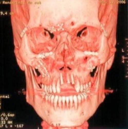 Retired NHL'er Crushed some faces and crushed mine too : )