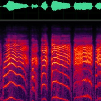 We study Central Auditory deficits at
Institut de l'Audition, research center of the @institutpasteur.
Michalski & Gourévitch lab
