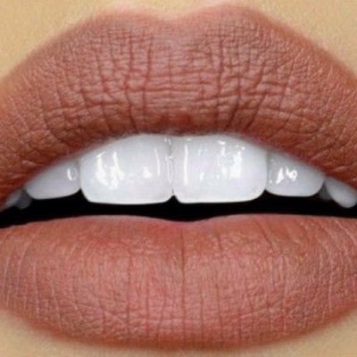 Transforming lives with clip in veneers for those in need 🦋 We rebuild lives 💯 Painless 💉 Dental lab direct 🌏 U.K. based ⬇️ TAP HERE