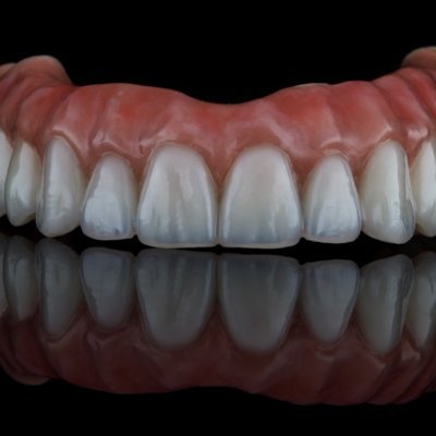 Production of all types of high-aesthetic dental restorations