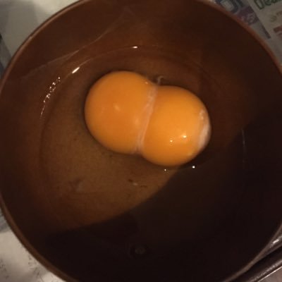 unchibanana's profile picture. 子宮外妊娠▶︎左卵管切除/PCOS 顕微授精( 凍結胚移植 )34週で前期破水して出産 🐶と👶が宝物 雑多垢