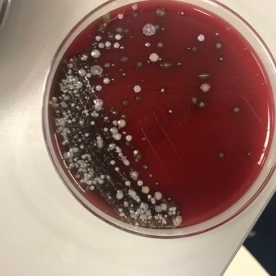 Clinical Microbiologist, Technical Director. D(ABMM). Opinions my own.