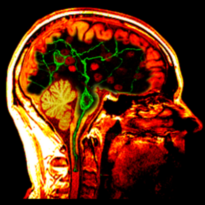 Brain & Neuroscience Advances Profile