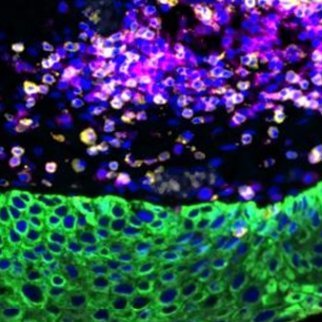 Sydney Cancer & Immunology Ideas Forum 16th August, NSW Teachers Federation Conference Centre @DrHelenMcGuire @doc_merlin @sarah_sasson @VittorioOrazio #CIIF24