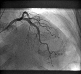 dmgoodhart's profile picture. Only hobby: Cardiology. Only complaint: Need a hobby